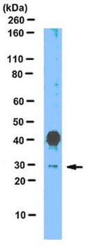 Anticorpo anti-SNAI1 (omologo di Snail 1) from rabbit, purified by affinity chromatography