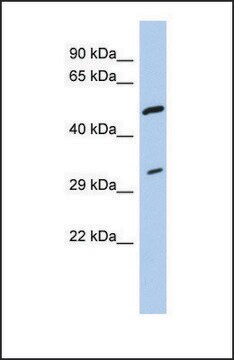 Anti-TPM3 antibody produced in rabbit affinity isolated antibody