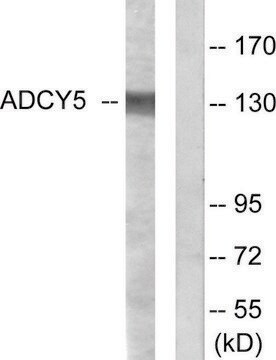 Anti-ADCY5, C-Terminal antibody produced in rabbit affinity isolated antibody