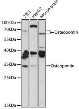 Anti-SPP1 antibody produced in rabbit