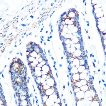 Anti-SFRP4 antibody produced in rabbit