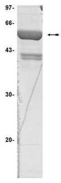 PRAK Protein, active, 15 &#181;g Active, N-terminal His6-tagged recombinant, human, full-length PRAK, for use in Kinase Assays.