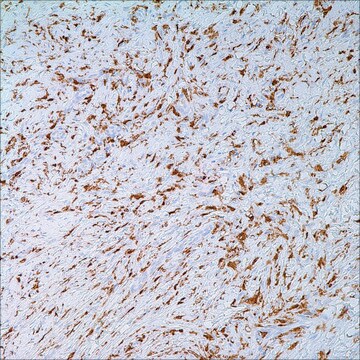 Factor XIIIa (EP3372) Rabbit Monoclonal Primary Antibody