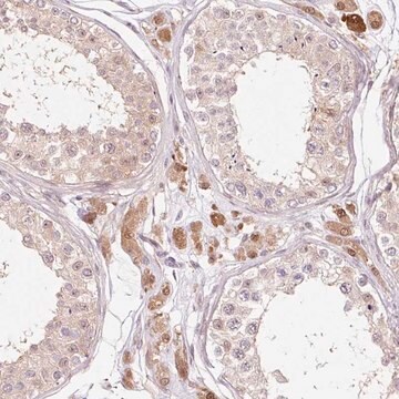 Anti-FBXL14 antibody produced in rabbit Prestige Antibodies&#174; Powered by Atlas Antibodies, affinity isolated antibody, buffered aqueous glycerol solution