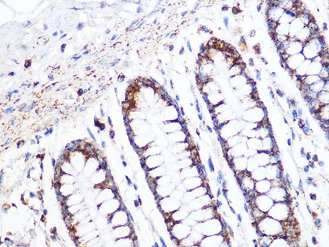 Anti-ACADM antibody produced in rabbit