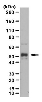 抗リン酸化NFkB p52（Ser222）抗体 from rabbit, purified by affinity chromatography