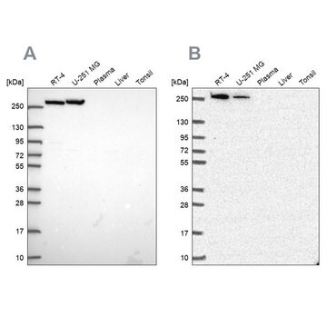 Anti-CAD Prestige Antibodies&#174; Powered by Atlas Antibodies, affinity isolated antibody