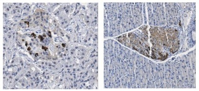 Anti-GLP1R Antibody from rabbit, purified by affinity chromatography