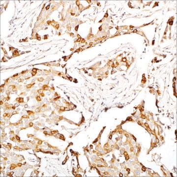 Mammaglobin (EP249) Rabbit Monoclonal Primary Antibody