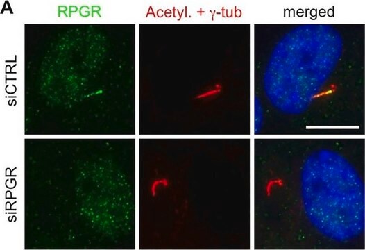 抗RPGR抗体 ウサギ宿主抗体 Prestige Antibodies&#174; Powered by Atlas Antibodies, affinity isolated antibody, buffered aqueous glycerol solution