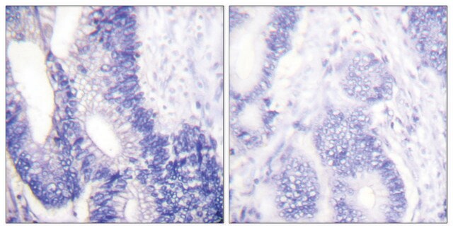 Anti-Claudin 3 antibody produced in rabbit affinity isolated antibody