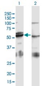 Anti-ATP5B antibody produced in mouse purified immunoglobulin, buffered aqueous solution