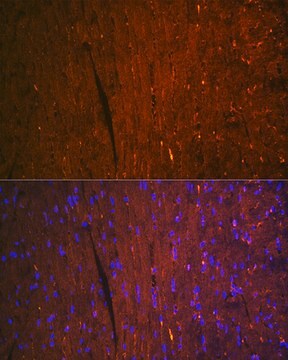 Anti-FABP3 Antibody, clone 9B9D7, Rabbit Monoclonal