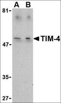 Anti-TIM-4 antibody produced in rabbit affinity isolated antibody, buffered aqueous solution