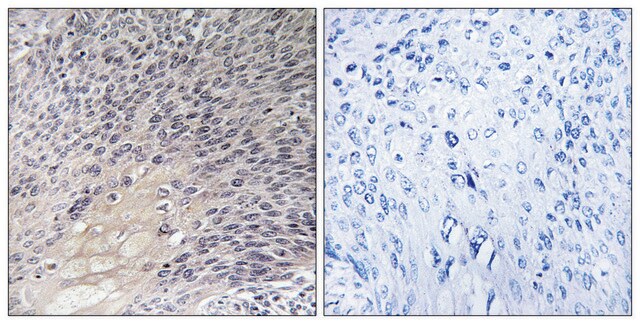 Anti-ARHGDIA antibody produced in rabbit affinity isolated antibody