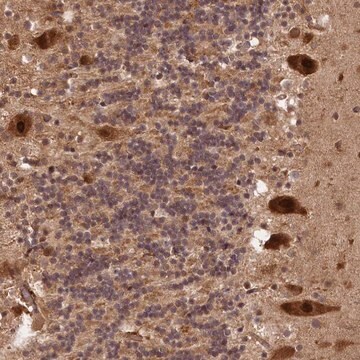 Anti-VPS51 antibody produced in rabbit Prestige Antibodies&#174; Powered by Atlas Antibodies, affinity isolated antibody, buffered aqueous glycerol solution