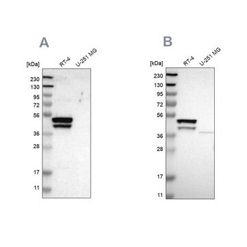 抗KRT23抗体 ウサギ宿主抗体 Prestige Antibodies&#174; Powered by Atlas Antibodies, affinity isolated antibody, buffered aqueous glycerol solution