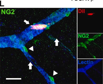 Anticorps anti-protéoglycane&nbsp;NG2 de type sulfate de chondroïtine Chemicon&#174;, from rabbit