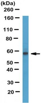 Anti-hCE-1 Antibody serum, from rabbit