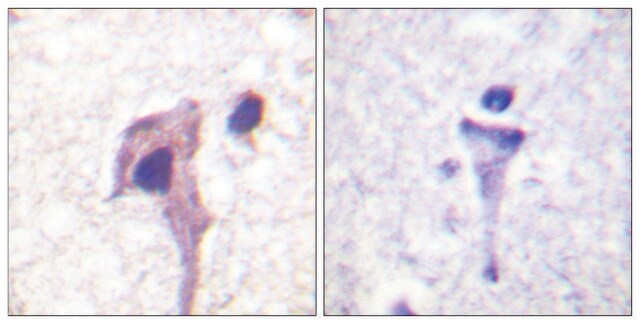 Anti-Synapsin1 antibody produced in rabbit affinity isolated antibody