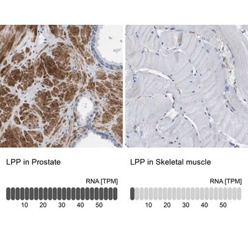 Anti-LPP antibody produced in rabbit Prestige Antibodies&#174; Powered by Atlas Antibodies, affinity isolated antibody, buffered aqueous glycerol solution