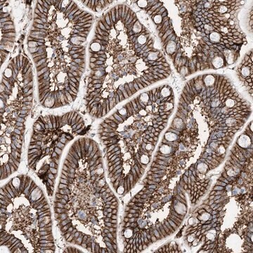 Anti-ATP11C antibody produced in rabbit Prestige Antibodies&#174; Powered by Atlas Antibodies, affinity isolated antibody, buffered aqueous glycerol solution