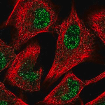 Anti-PFKFB3 antibody produced in rabbit Prestige Antibodies&#174; Powered by Atlas Antibodies, affinity isolated antibody