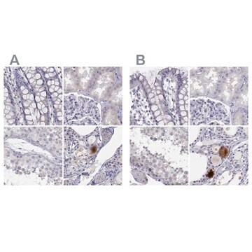 Anti-C16orf89 antibody produced in rabbit Prestige Antibodies&#174; Powered by Atlas Antibodies, affinity isolated antibody