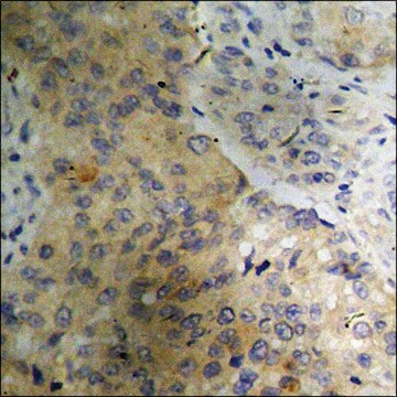 Anti-phospho-PLB (pSer16+Thr17) antibody produced in rabbit affinity isolated antibody