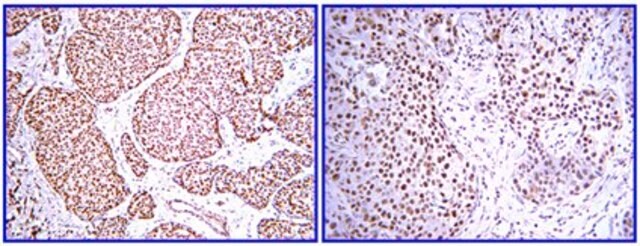 Anti-PDGF-BB-Antikörper from rabbit, purified by affinity chromatography