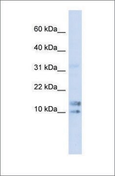 抗IL15抗体 ウサギ宿主抗体 affinity isolated antibody