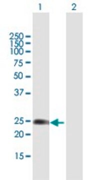 Anti-WISP2 antibody produced in mouse purified immunoglobulin, buffered aqueous solution