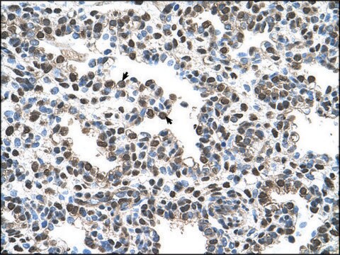 Anti-AGER affinity isolated antibody