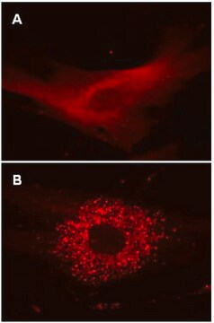 Biocapteur lentiviral LentiBrite RFP-LC3