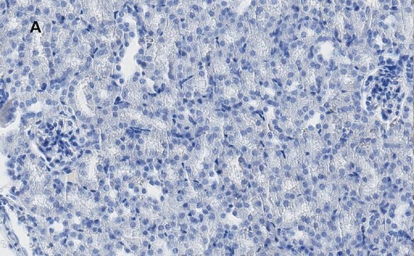 Anti-MLKL Antibody, clone 3F13, ZooMAb&#174; Rabbit Monoclonal recombinant, expressed in HEK 293 cells