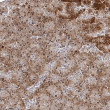 Anti-PIP4K2C antibody produced in rabbit Prestige Antibodies&#174; Powered by Atlas Antibodies, affinity isolated antibody, buffered aqueous glycerol solution