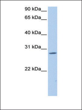 Anti-NRIP3 antibody produced in rabbit affinity isolated antibody