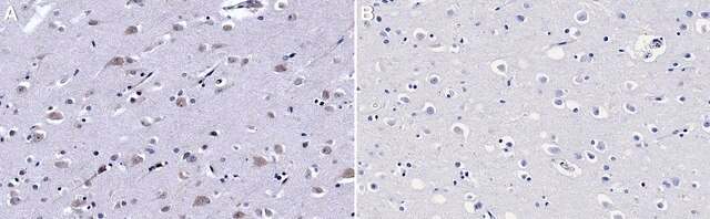 Anticorpo anti-eIF2&#945; IgG fraction of antiserum, buffered aqueous solution