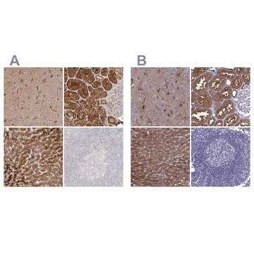 Anti-ALDH1L1 antibody produced in rabbit Prestige Antibodies&#174; Powered by Atlas Antibodies, affinity isolated antibody, buffered aqueous glycerol solution