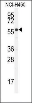 Anti-CYP21A2 (N-term) antibody produced in rabbit saturated ammonium sulfate (SAS) precipitated, buffered aqueous solution