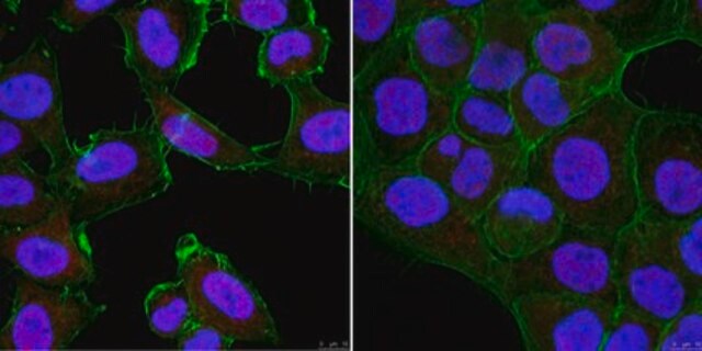 Anti-SMARCD2 (BAF60B) from rabbit, purified by affinity chromatography