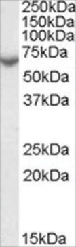 Anti-Arylsulfatase C/STS antibody produced in goat affinity isolated antibody, buffered aqueous solution