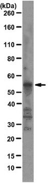 Anti-Fox1 Antibody, clone D8F8 clone D8F8, from mouse