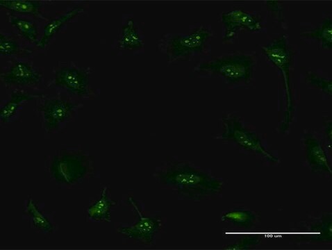 Monoclonal Anti-S100A7 antibody produced in mouse clone 1C5-C6, purified immunoglobulin, buffered aqueous solution