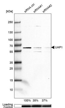 抗UAP1抗体 ウサギ宿主抗体 Prestige Antibodies&#174; Powered by Atlas Antibodies, affinity isolated antibody, buffered aqueous glycerol solution