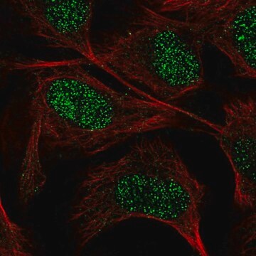 Anti-GUCY1A3 antibody produced in rabbit Prestige Antibodies&#174; Powered by Atlas Antibodies, affinity isolated antibody