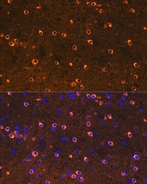 Anti-CRMP2/DPYSL2 antibody produced in rabbit