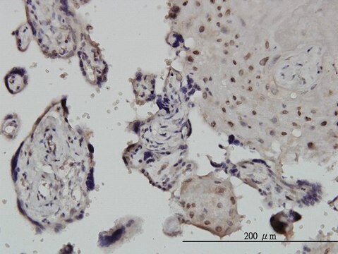 Monoclonal Anti-CHUK, (C-terminal) antibody produced in mouse clone 2G4, purified immunoglobulin, buffered aqueous solution