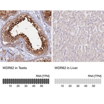 Anti-WDR62 antibody produced in rabbit Prestige Antibodies&#174; Powered by Atlas Antibodies, affinity isolated antibody, buffered aqueous glycerol solution