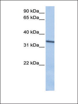 Anti-SEPT9 antibody produced in rabbit affinity isolated antibody